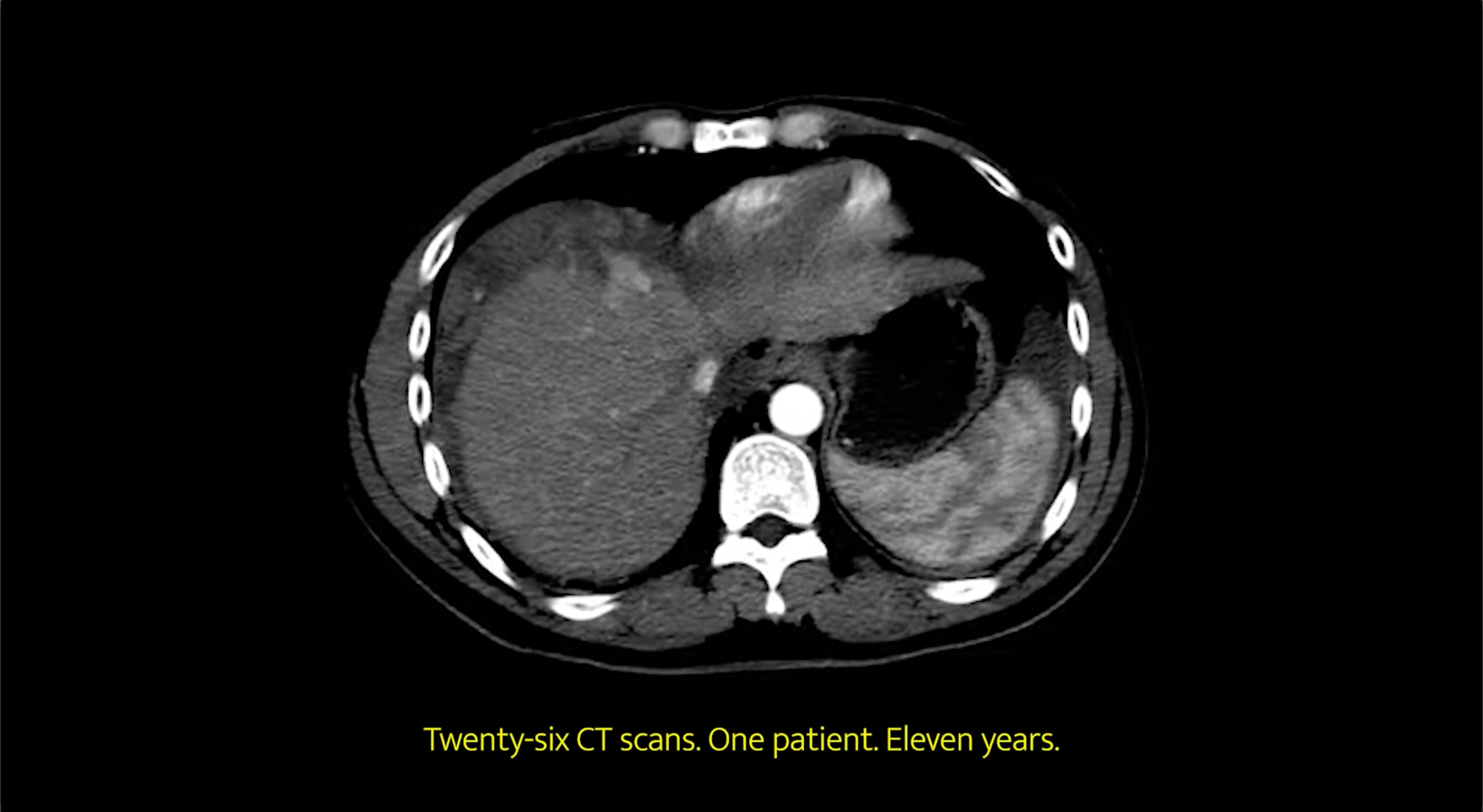 The Sound of Reasoning — still, twenty-six CT scans, one patient, eleven years